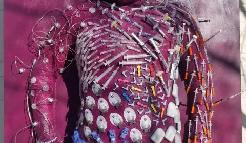 Over the summer I decided that I wanted to take on a big project because to me, a big project meant a big impact. Once again had a lot of my own used supplies but this time I also got supplies from others to show a full spectrum of supplies. I wanted this piece to stand out but also be personalized so naturally I thought the best way to do that was to make a life-sized cast of my body. I covered it to show how diabetes surrounds you 24/7 whether you want it to or not. You may think it’s random or overwhelming but sometimes I feel that way about diabetes.